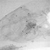 Fish Bite Force: X-ray animation sequence: In live X-ray video, a black carp manages to crush a tube full of food deep in its mouth. The size of the tube has a major influence on the strength of its bite. The video also shows a computer animation of its jaw bones.