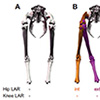 Figure 3. Individual and combined consequences of LAR. (A) Cranial view of a neutral pose. (B) Internal hip LAR (orange) moves the right foot laterally while external hip LAR (purple) moves the foot medially. (C) External knee LAR (orange) moves the right foot laterally and toes out while internal knee LAR (purple) moves the foot medially and toes in. (D) Internal hip LAR and external knee LAR (orange) are additive, as are external hip LAR and internal knee LAR (purple). (E) Combining internal (orange) and external (purple) LARs generates a range of digital axis angles at a similar toe position.